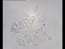 各种白带图片,揭秘女性私密健康信号